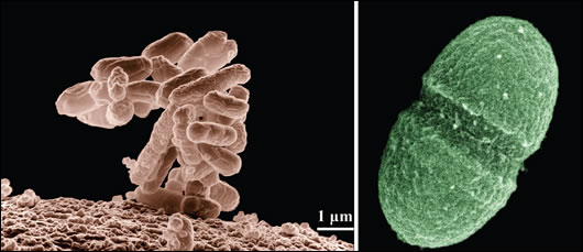 Both E.Coli (left) and Enterococci bacteria (right) are common contaminants in private group water schemes Both E.Coli (left) and Enterococci bacteria (right) are common contaminants in private group water schemes
